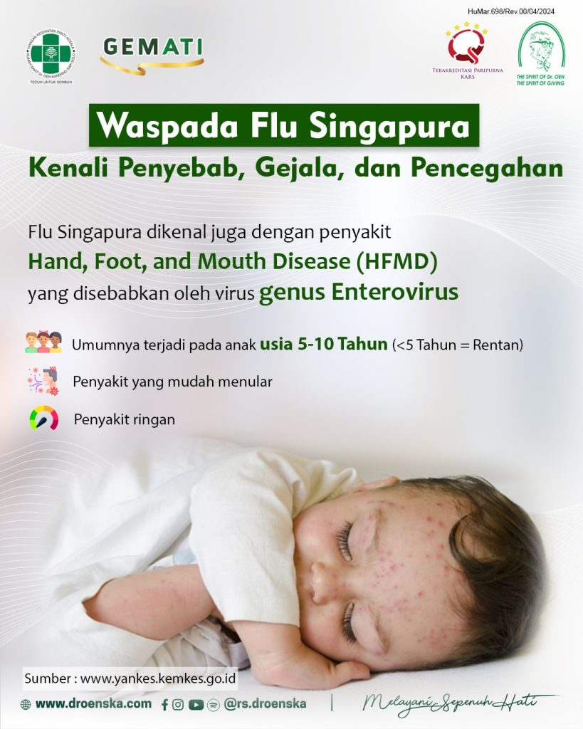 Waspada Flu Singapura